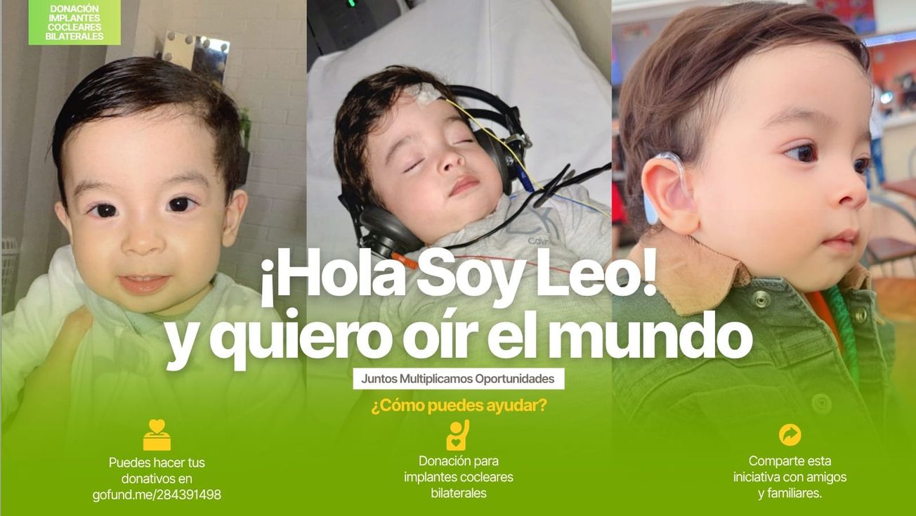 Fundación pide apoyo para que Leonel pueda escuchar gracias a un implante coclear