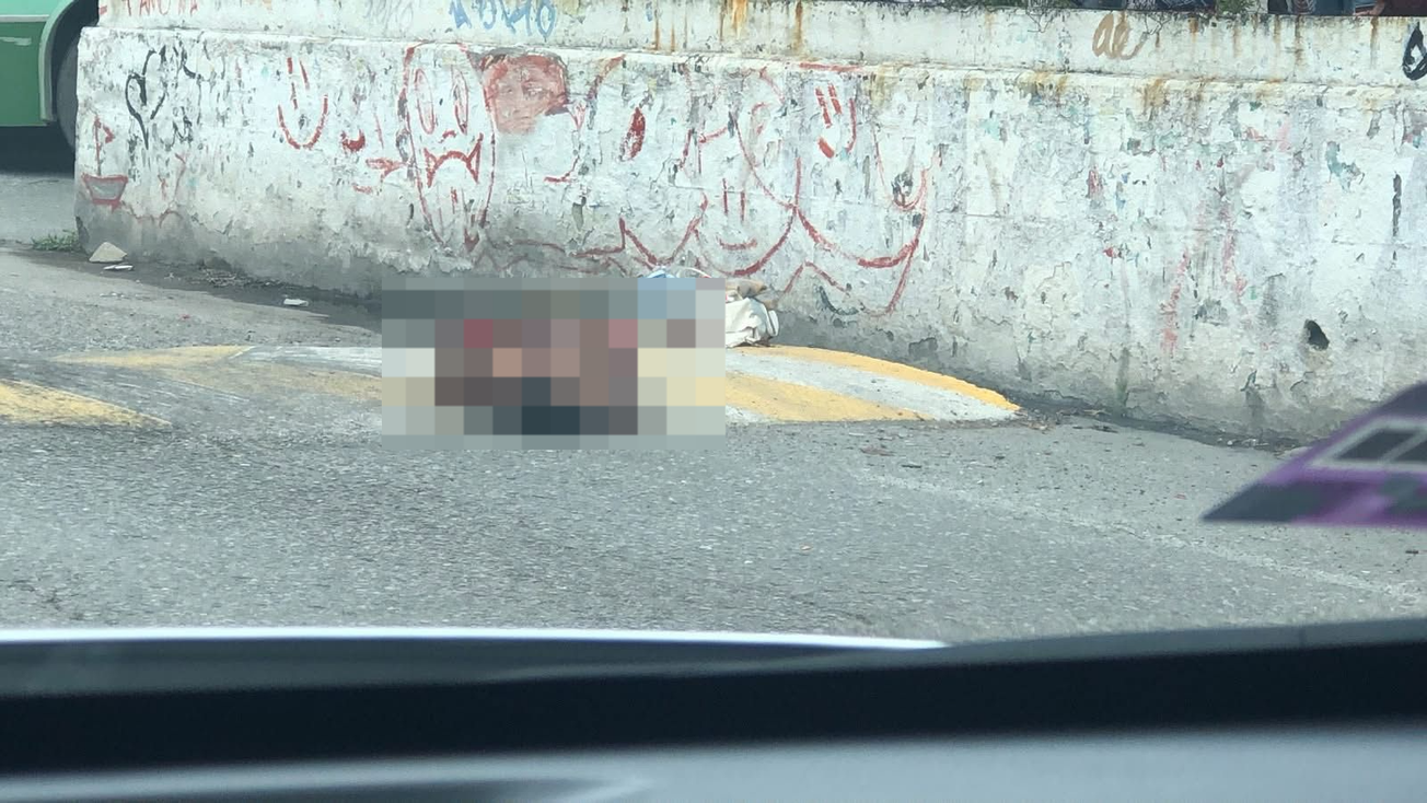 Atacan a hombre en silla de ruedas en Acatlipa, Temixco