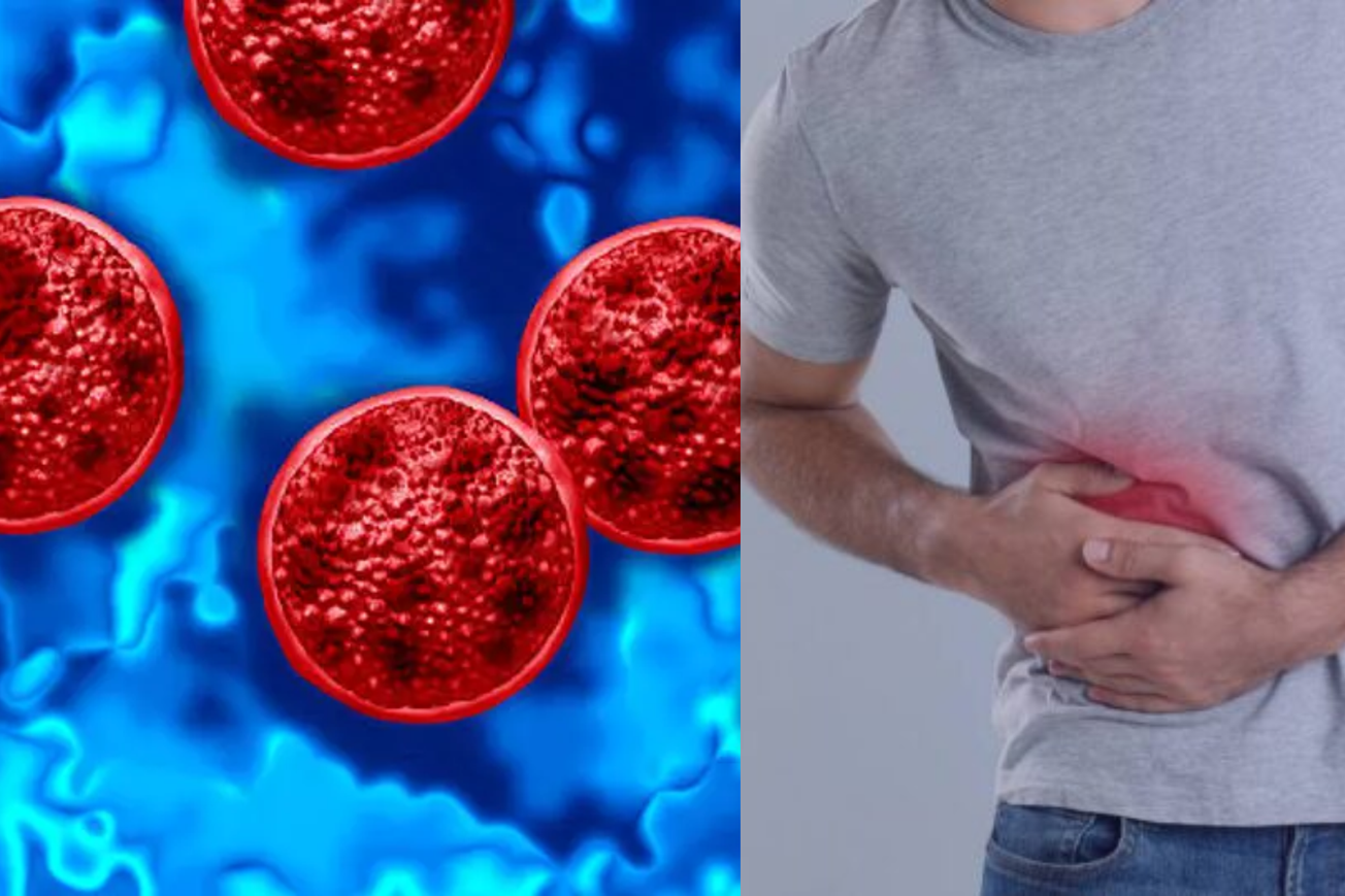 ¿Qué es la ciclosporiasis? La enfermedad que tiene varios brotes en EE. UU.
