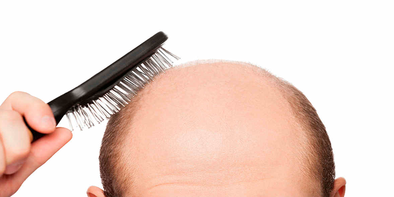 ¿Se te cae el cabello? Debes evitar comer estos alimentos