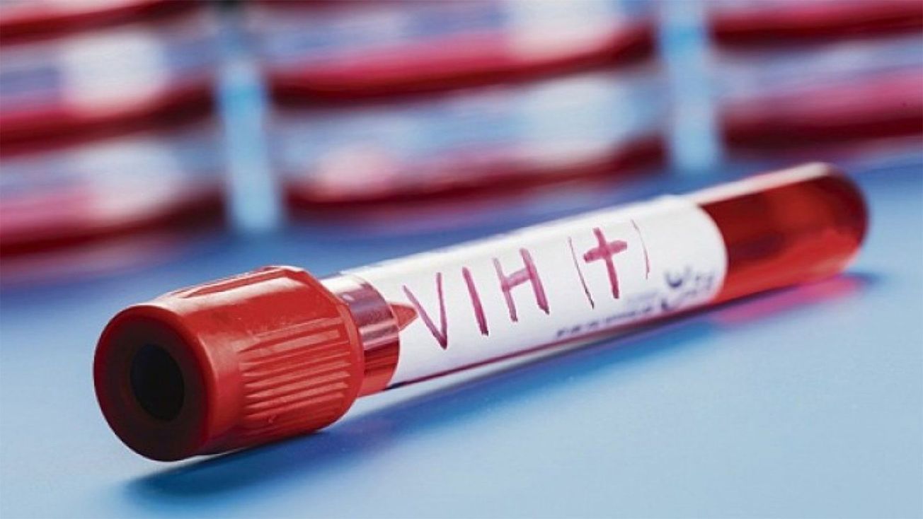 ¿Vacuna contra el VIH en 2030?
