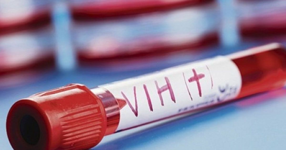 Aumentan casos de VIH en Morelos