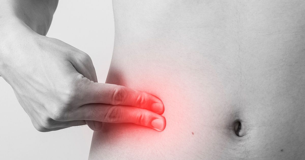 ¿Cómo detectar síntomas de apendicitis?