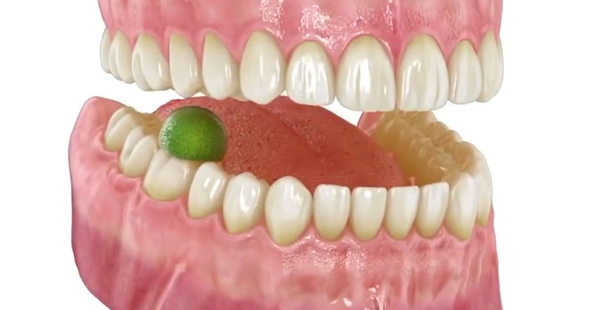 Salud en 24 – Caries