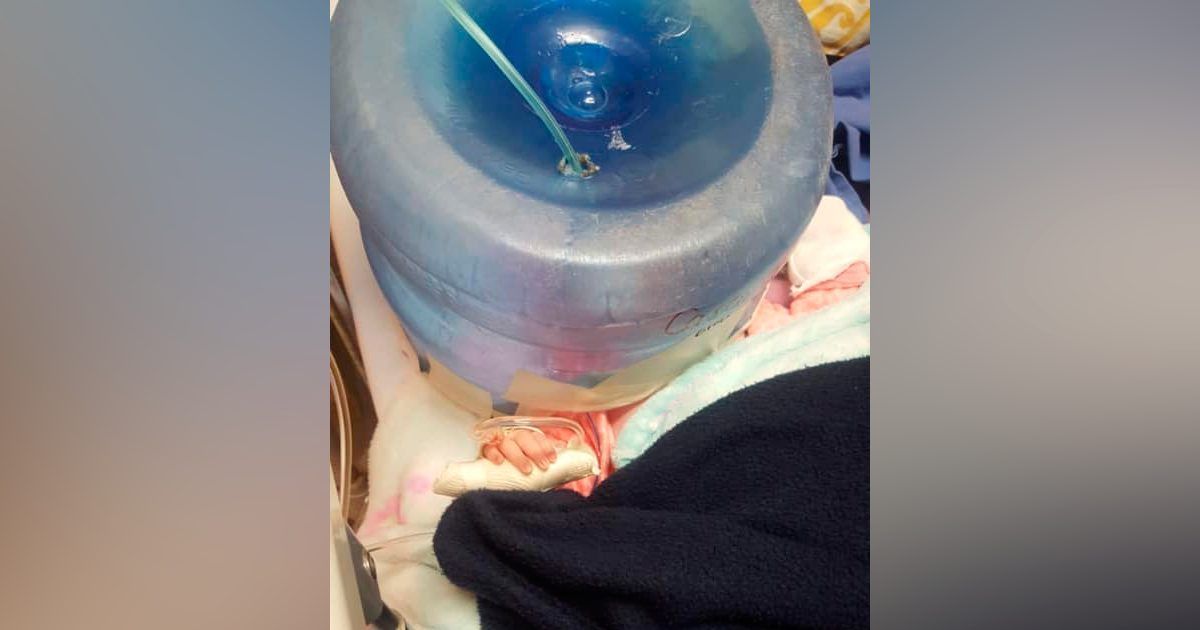 Utilizan garrafón como incubadora en hospital de Sonora