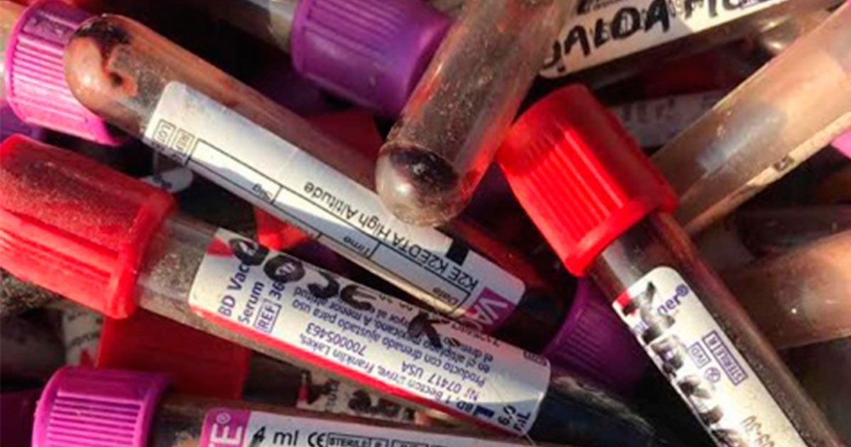 Niños juegan con muestras de sangre abandonadas en Chiapas