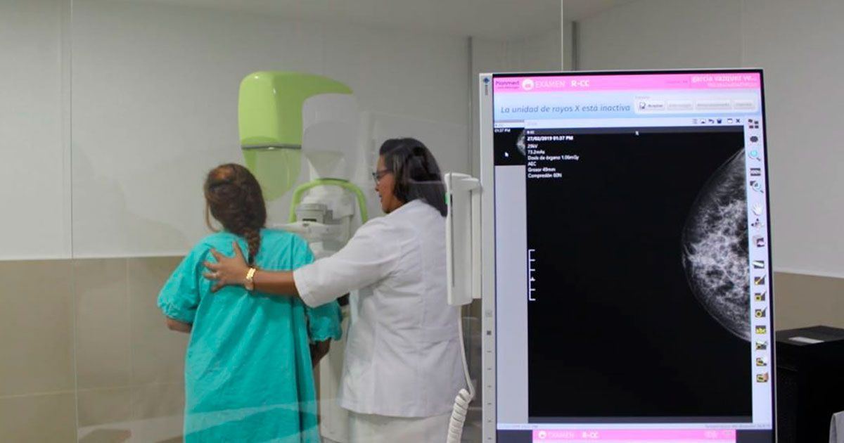 IMSS Morelos invierte en equipo digital para mastografía