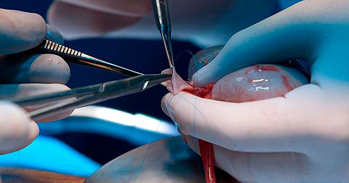 Enfermedad renal: Problema de salud creciente