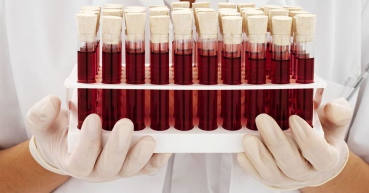 Crean prueba para detectar Alzheimer