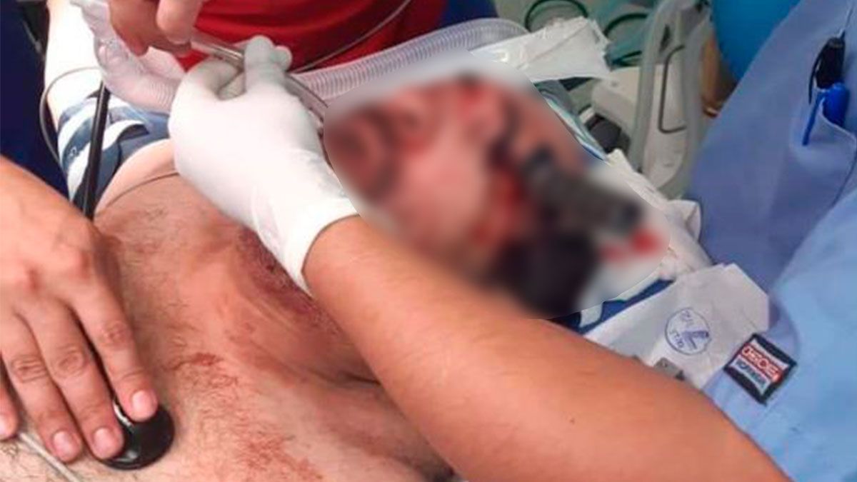 Pelea por lugar de estacionamiento en Veracruz, termina con cuchillo en la cara