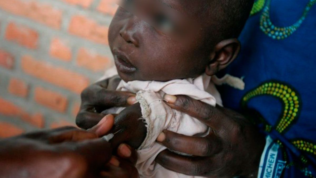 Sarampión mata a 2 mil en el Congo