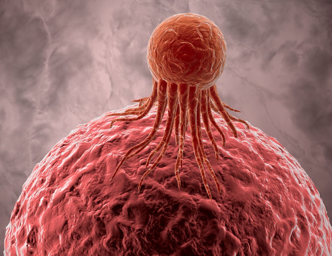 Vacuna logra detener el cáncer de mama de una mujer en EU