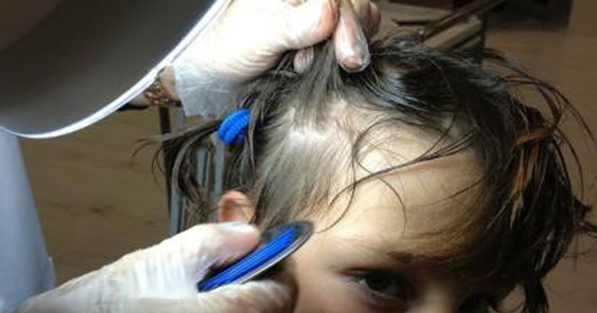 Previene el contagio de piojos en los menores