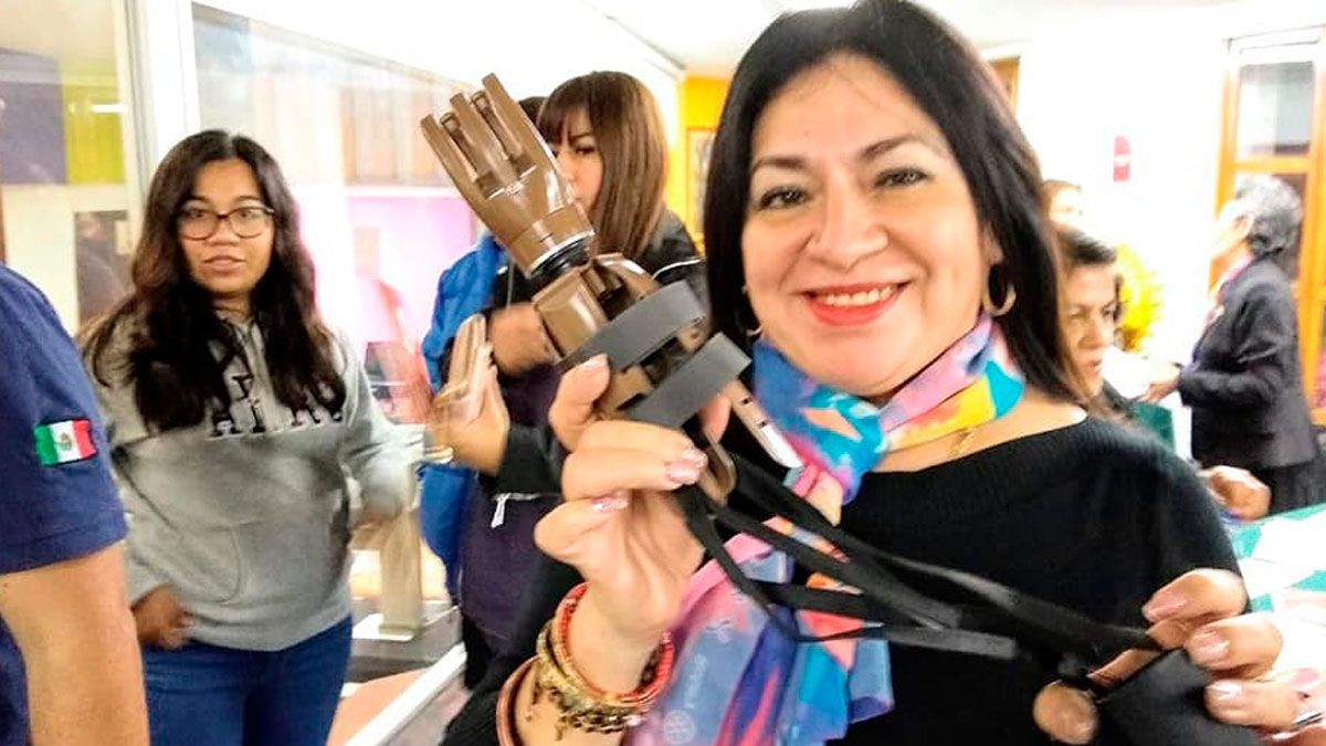 Con programa “Te damos una mano” entregarán prótesis gratuitas