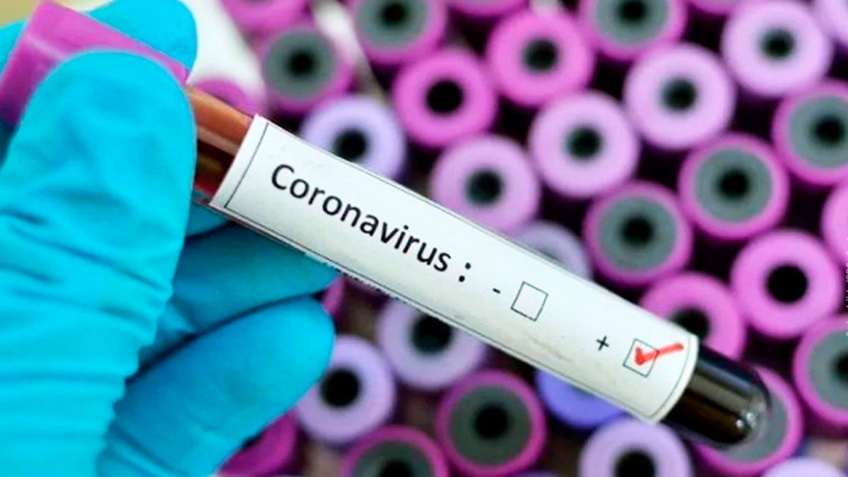 Activan protocolos sanitarios por dos casos sospechosos de Covid-19 en Morelos