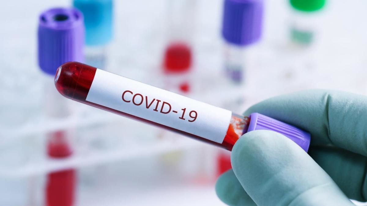 En segunda oleada de contagios atendieron 25 llamados diarios por Covid-19