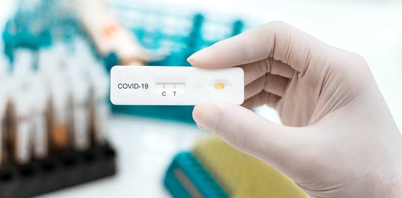 No compres pruebas rápidas Covid-19 en lugares no establecidos