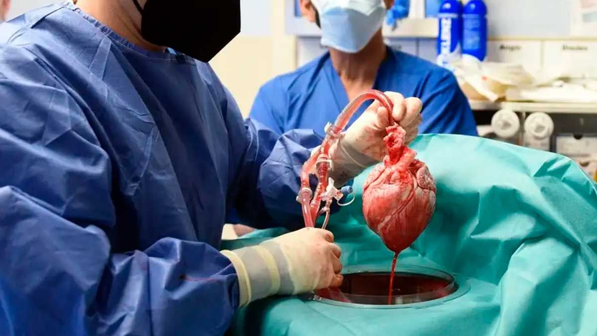 Detectan posible causa de muerte del primer hombre que recibió trasplante de cerdo