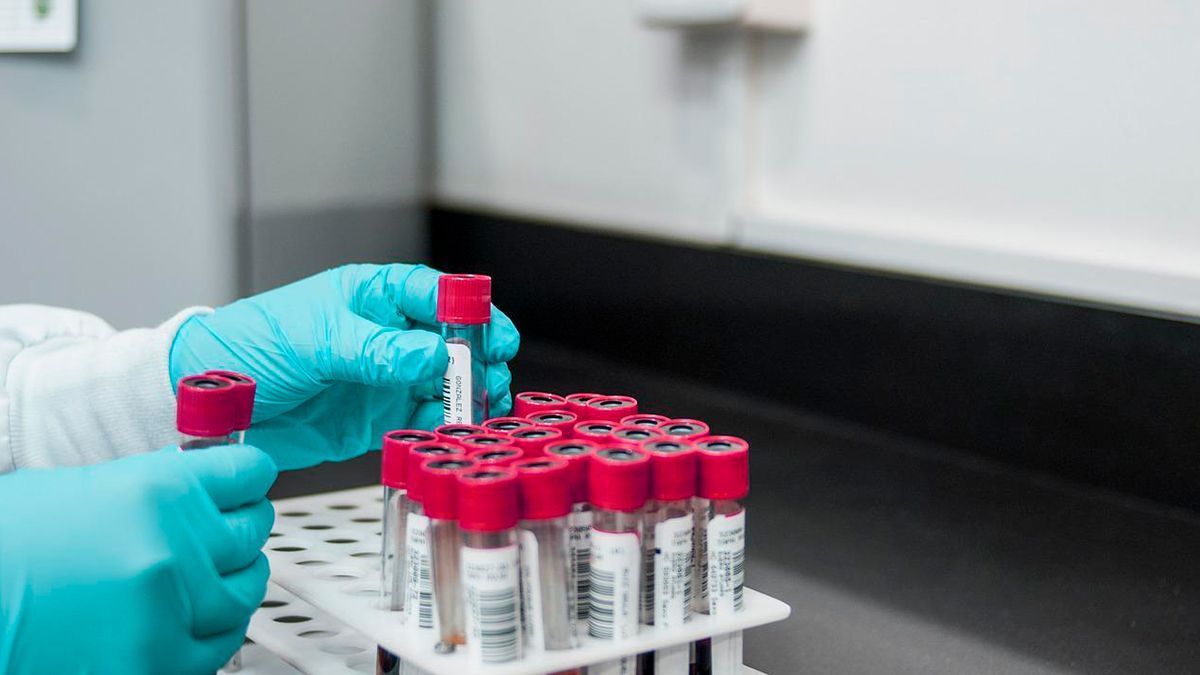Descartan casos de viruela símica en Morelos