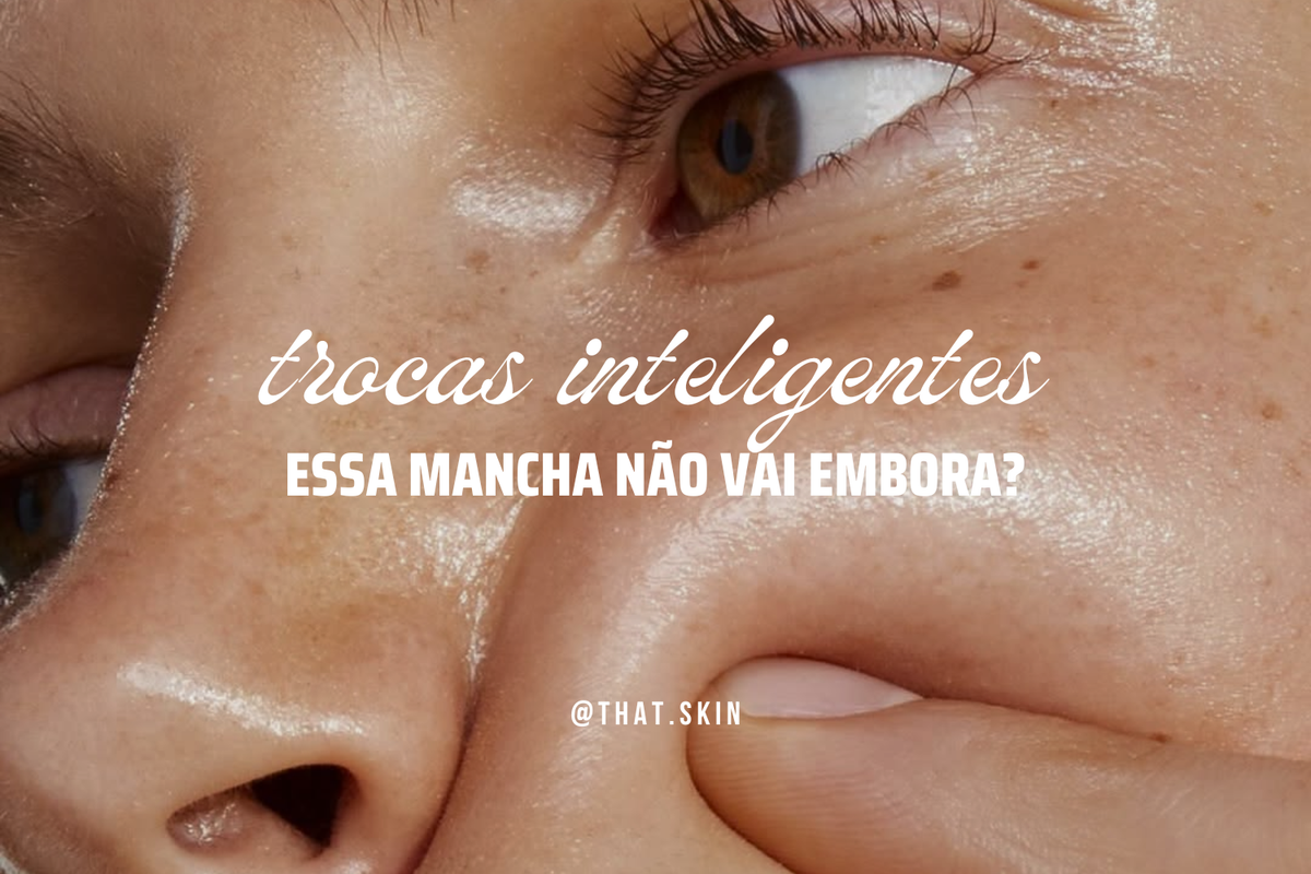 Essa mancha não vai embora?