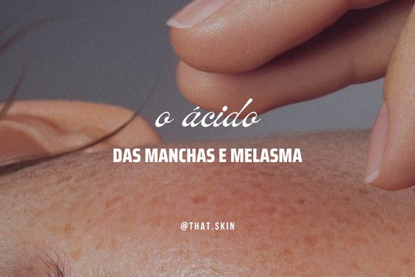 O Ácido Para Tratar Manchas E Melasma
