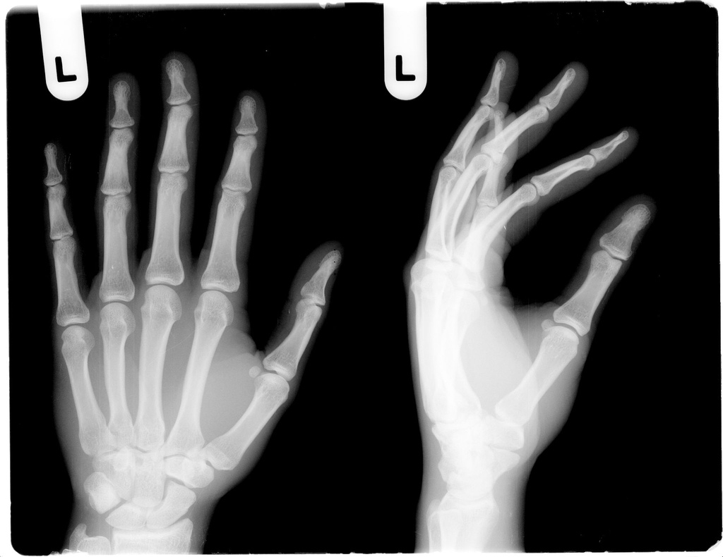 Left hands