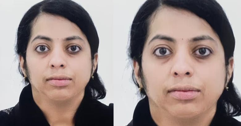 ജോലിക്കിടെ ന്യുമോണിയ ബാധിച്ചു; സൗദിയിൽ മലയാളി നഴ്‌സിന് ദാരുണാന്ത്യം