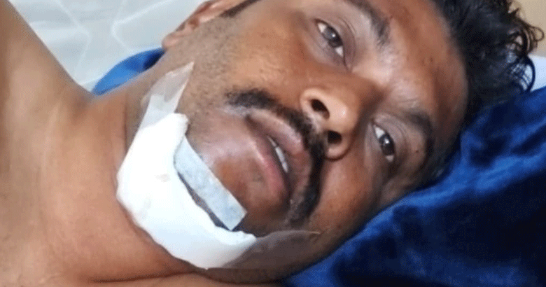 യാത്രക്കാരെന്ന വ്യാജേന കാറിൽ കയറി, വിജനമായ സ്ഥലത്തെത്തിച്ച് ആക്രമണം: സൗദിയിൽ മലയാളി ഡ്രൈവർക്ക് ഗുരുതര പരിക്ക്