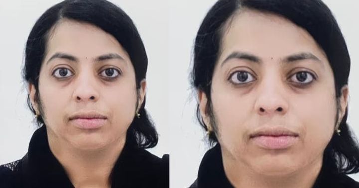 ജോലിക്കിടെ ന്യുമോണിയ ബാധിച്ചു; സൗദിയിൽ മലയാളി നഴ്‌സിന് ദാരുണാന്ത്യം