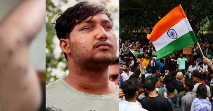 നീറ്റ് പ്രതിഷേധത്തിലെ പെല്ലറ്റ് പ്രയോഗം; പരിക്കേറ്റയാളുടെ ശരീരത്തിൽ ലോഹഭാഗങ്ങൾ കണ്ടെത്തിയതായി റിപ്പോർട്ട്