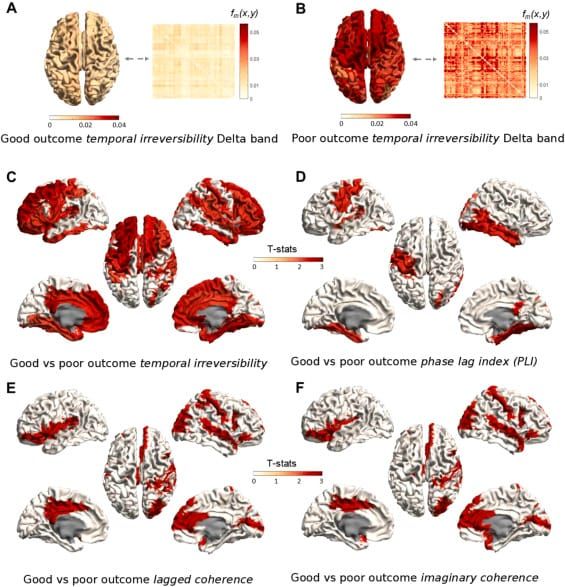 "Building blocks of functional connectivity measures for aperiodic electrophysiological brain signals" has been published