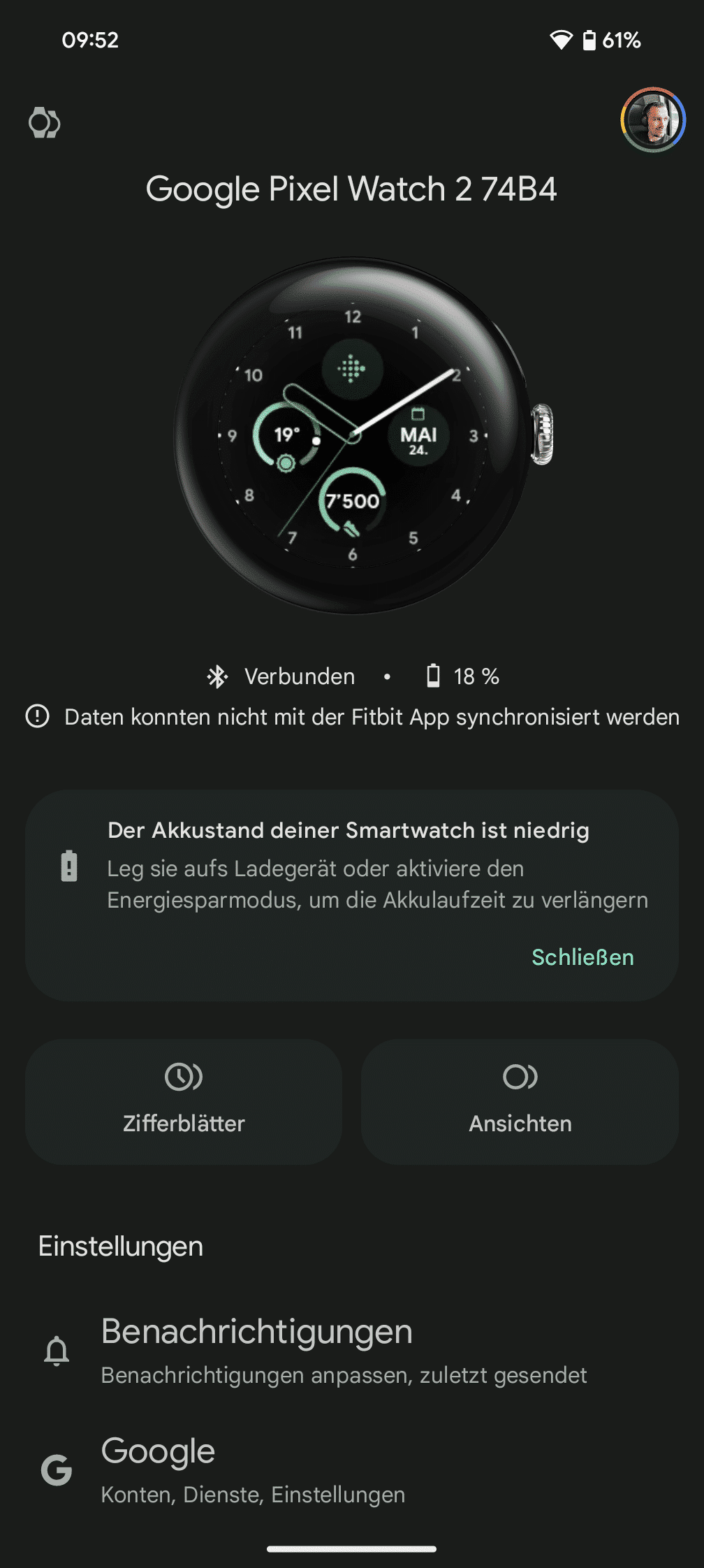 Über die Watch-App werden alle Einstellungen vorgenommen