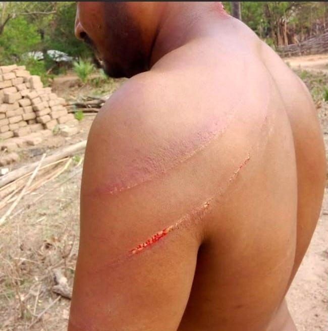 Christian Pastor and His Family Beaten Bloody in India: Niece Slashed Across the Face With Wooden Stick