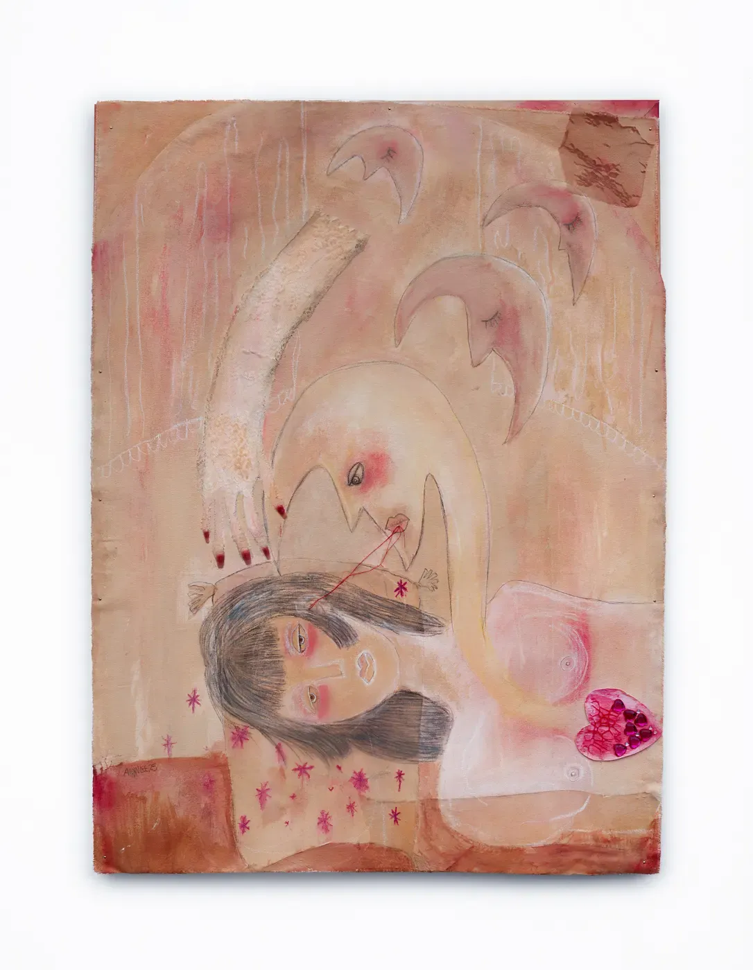 Painting by Ailyn Lee of a reclining female figure on pink-skin canvas; red thread pulls from her head to a ghostly creature; lace textures, heart sticker on chest; mixed media on raw canvas, 30×40 inches, 2025.
