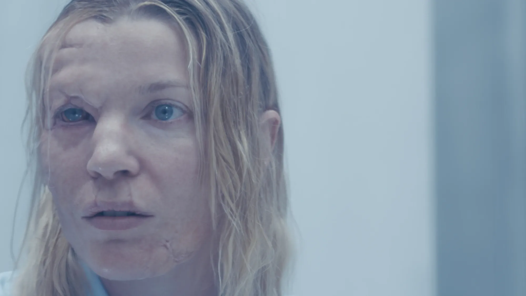 Exhibition review of I Think My Body No Longer Belongs to Me at roam projects e. V., Berlin, 2026. Close-up of a blonde woman's face with fine scars.