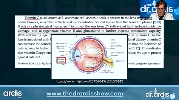Cataracts: Natural and Proven Solutions (Part 2)