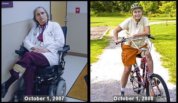 The Woman Who Defeated Her Own Multiple Sclerosis – Dr. Terry Wahls