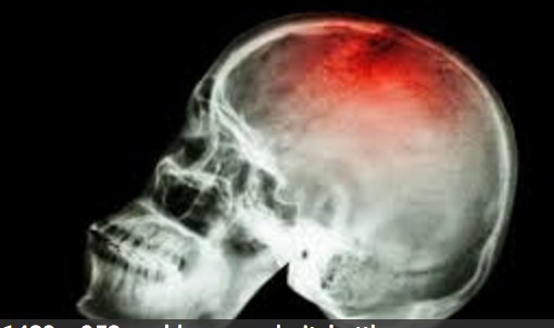 How a Concussion Can Destroy Your Body and Your Health with Dr. Mark Gordon and Tone Floreal
