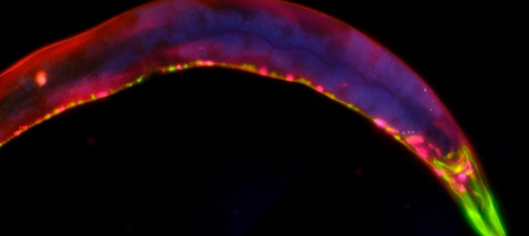 Caenorhabditis elegans