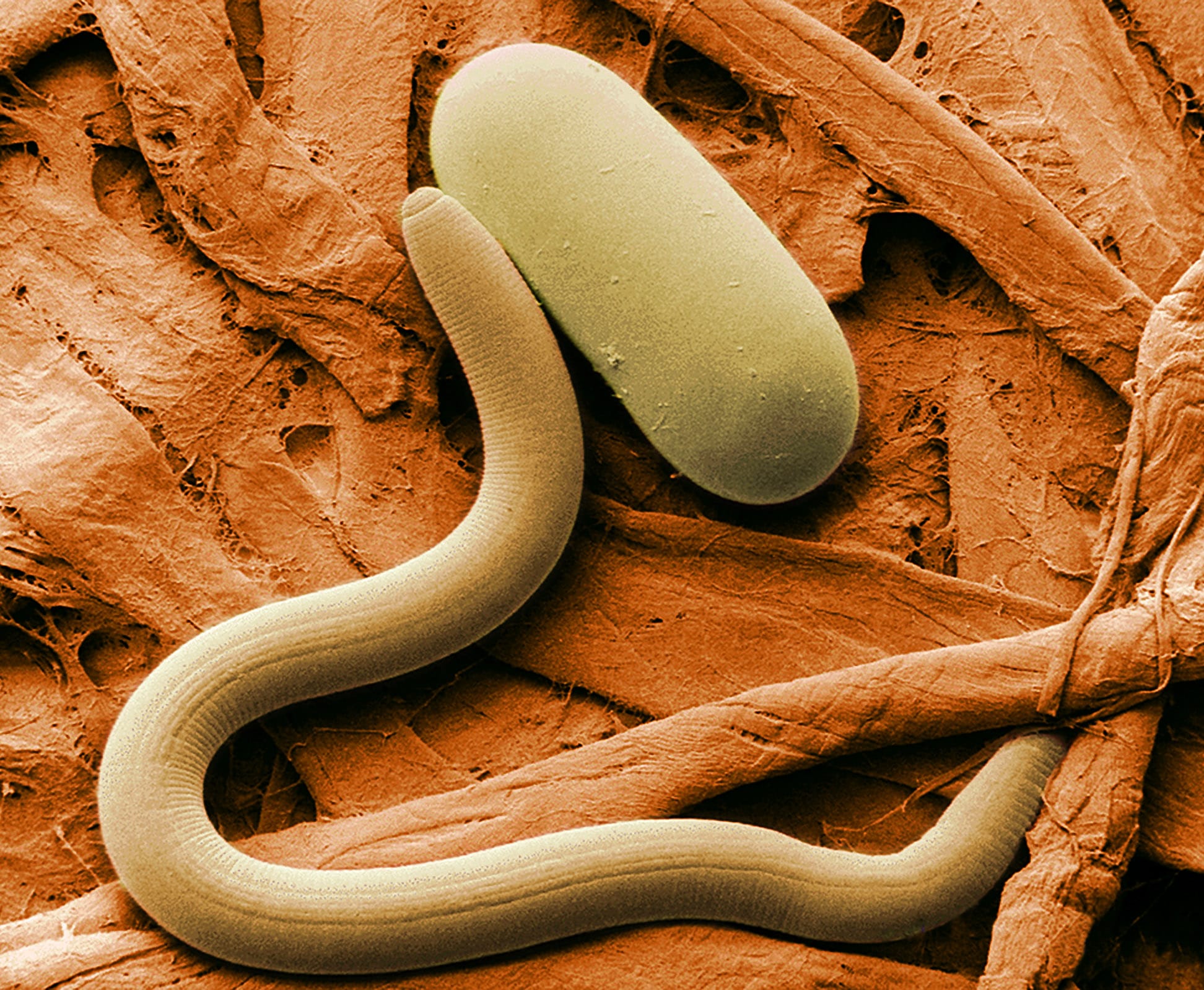Colorized electron micrograph of soybean cyst nematode (Heterodera glycines) and egg