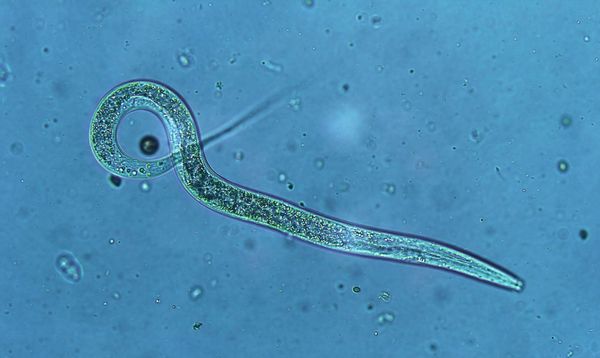 Microscopic Nematode
