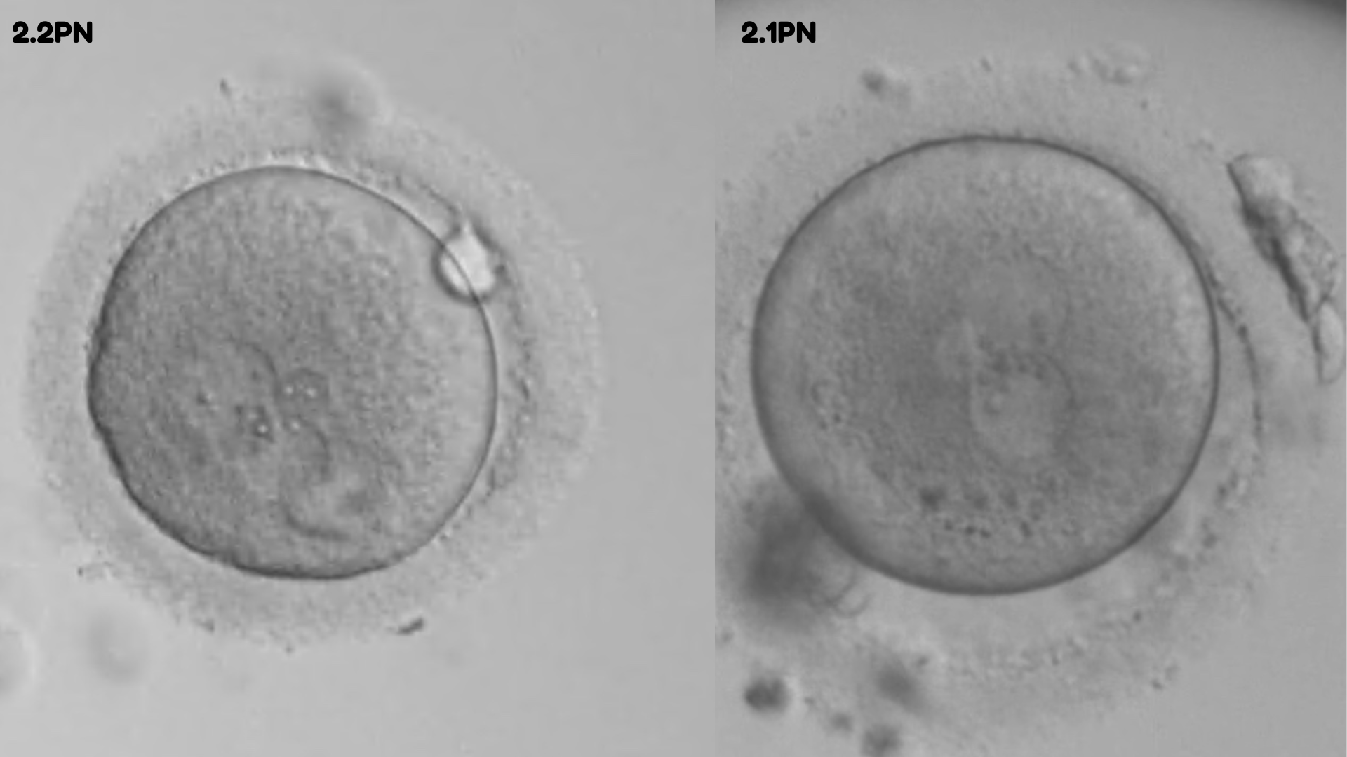 Two images of a magnified image of an embryo. On the left hand side there are different sized nucleus'. On the right hand side there are two large and one small nuclei.