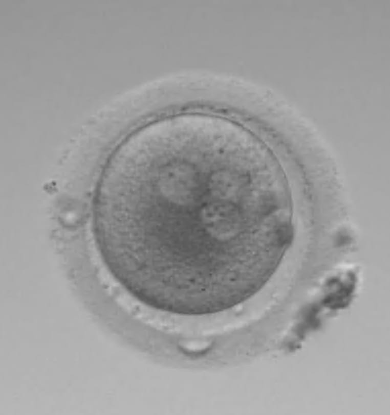 A magnified image of an embryo. There are three visible nucleus'.