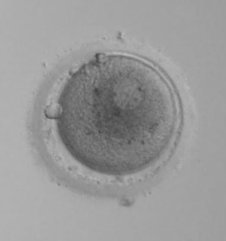 A magnified image of an embryo. There is one visible nucleus.