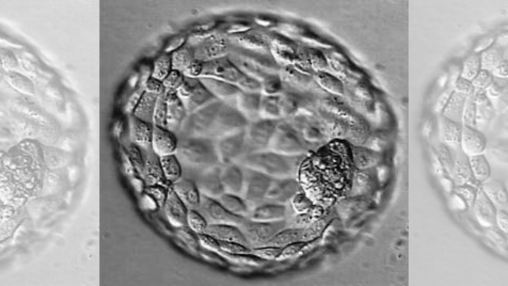 A microscopic image of a fully hatched blastocyst