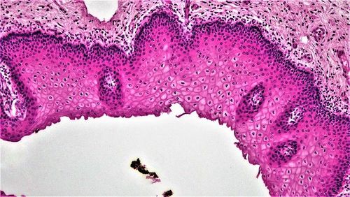 Научни новини: Нов механизъм за борба с COVID-19 и пръстени вместо луни
