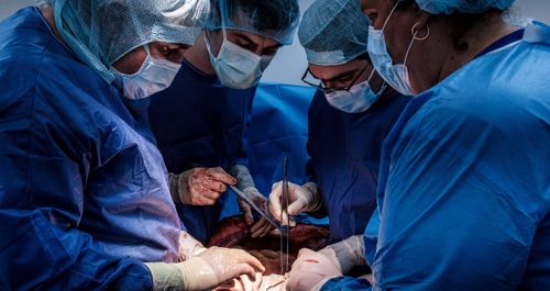 Лекари по време на трансплантация