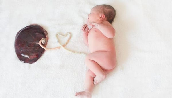 Photograph of a baby alongside the placenta, still attached via umbilical cord