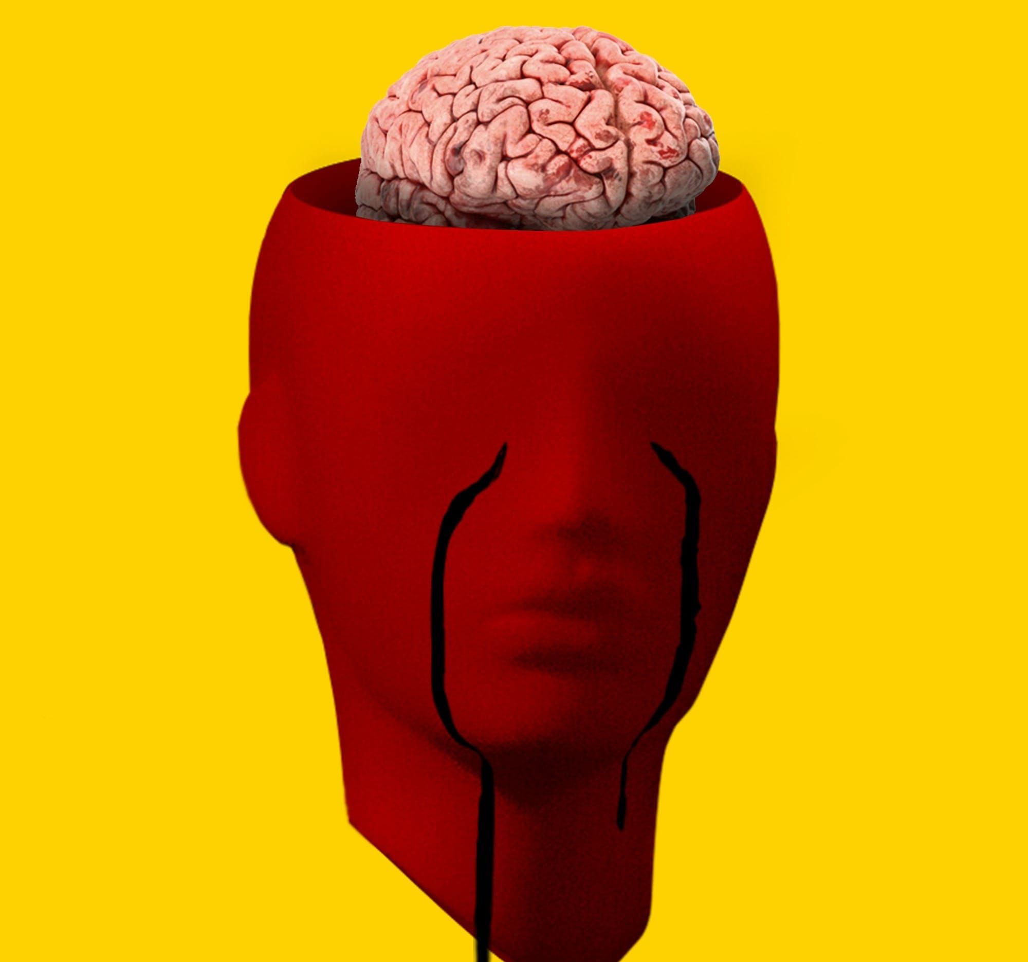 Representación de un derrame cerebral