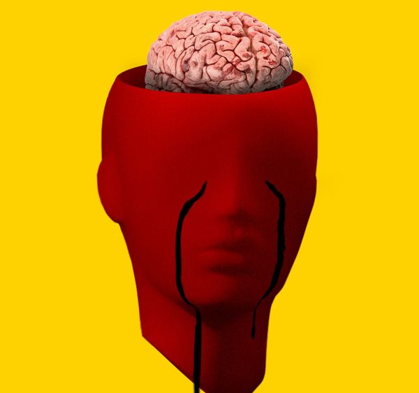 Representación de un derrame cerebral